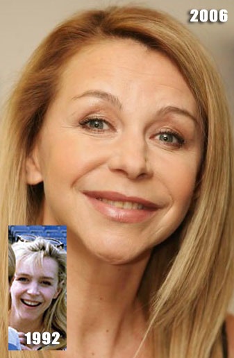 Leslie Ash in various years before lip treatment